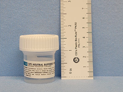 Prefilled 20 ML